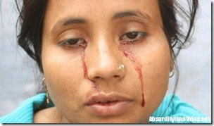 Rashida-Khatoon-Bloody-Eye