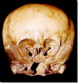 starchild-skull