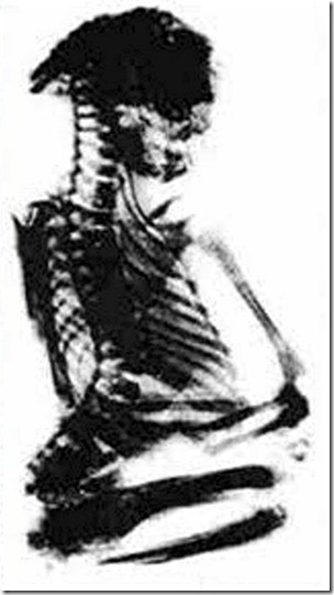 Pedro, Wyoming mini-mummy, 1950 x-ray, public domain