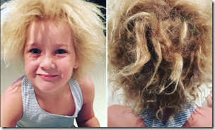 uncombable-hair-syndrome2