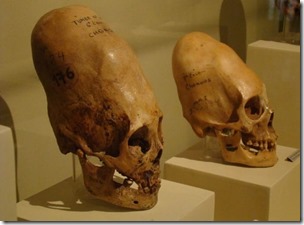 Paracas-skulls