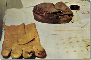 stephen-michalak-burned-glove-and-hat