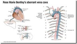 190408083958-20190408-backwards-organs-vena-cava-exlarge-169