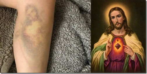 el-hematoma-la-cara-jesus-que-se-le-formo-despues-caerse-la-bicicleta