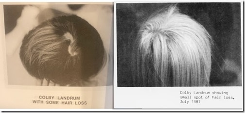 Colby Landrum Hair 1981